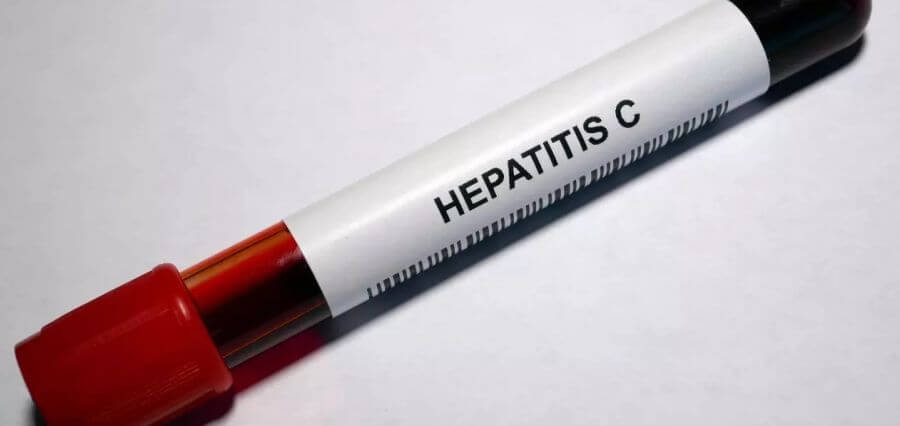 Hepatitis C